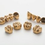 金の入れ歯は売れるの？金歯買取で高く売るコツと買取相場をわかりやすく解説